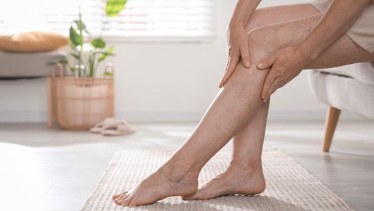 Czy hirudoterapia może pomóc w walce z żylakami kończyn dolnych?