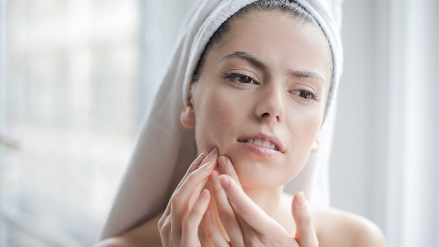 Skóra, która nie regeneruje się prawidłowo w miejscach intensywnej mimiki