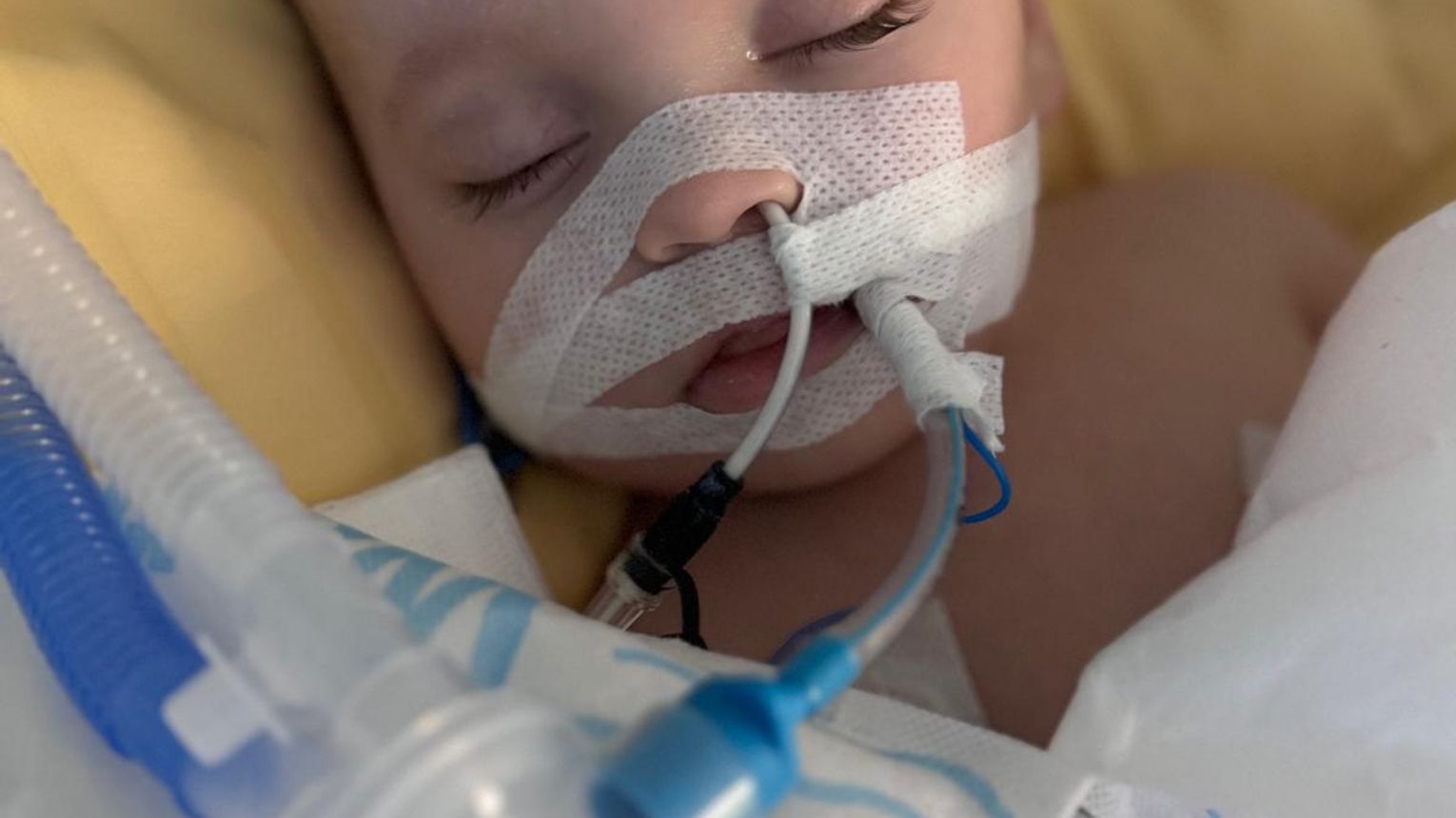 Wesprzyj Marcelinkę w walce z ostrą niewydolnością nerek